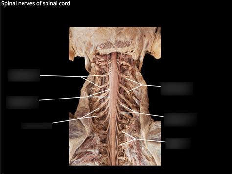 Nervous System Pal Cadaver Diagram Quizlet