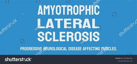 Amyotrophic Lateral Sclerosis Neurodegenerative Disease Affecting Stock Vector Royalty Free