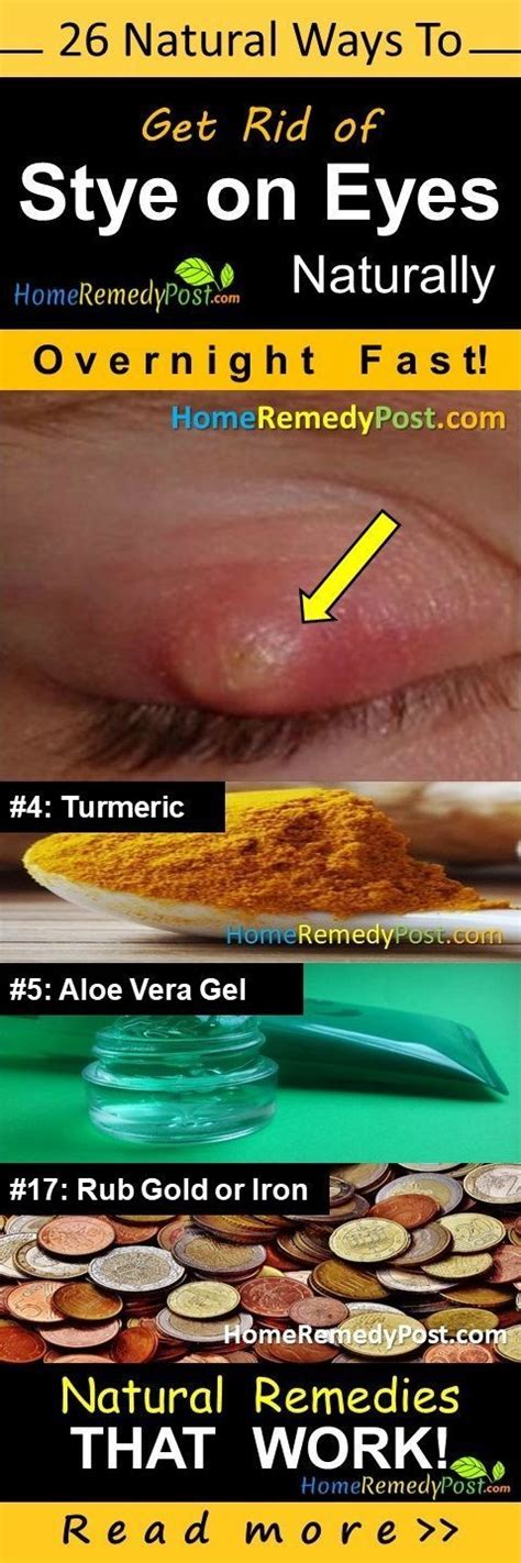 How To Get Rid Of A Stye 26 Fast Effective Home Remedies For Stye Under And Upper Eyelid Styes