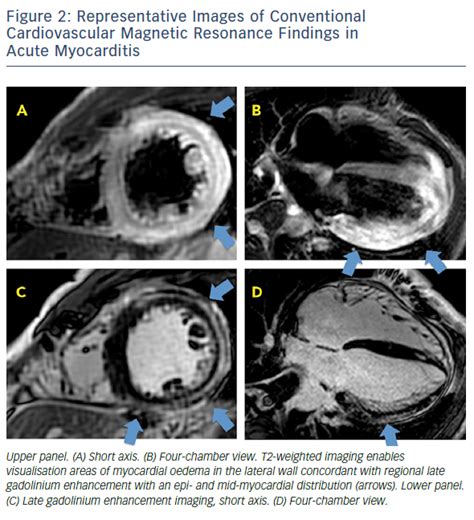 Figure 2 Representative Images Of Conventional Cardiovascular Magnetic