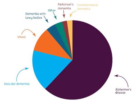 Dementia With Lewy Bodies Explained Alzheimers Research Uk