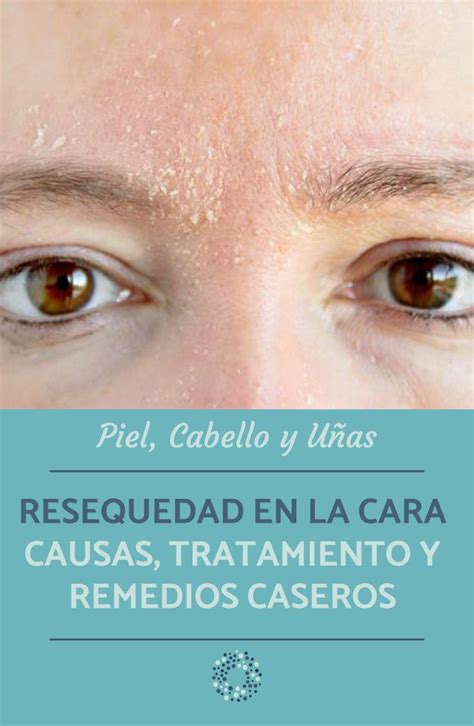 Resequedad En La Cara Causas Tratamiento Y Remedios Caseros Cara