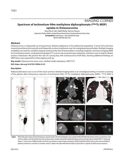 Pdf Spectrum Of Technetium 99m Methylene Diphosphonate 99mtc Mdp