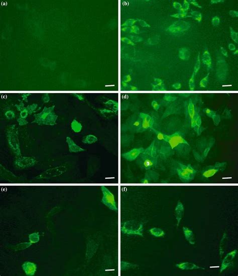 Cellular Localization Of MAChR In CHO K1 NIH 3T3 Cells Cells Stably