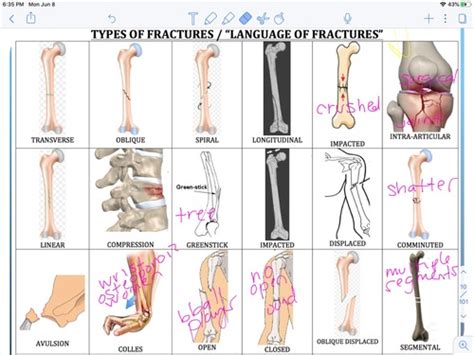 MSK Part 1 Medical Imaging Flashcards Quizlet