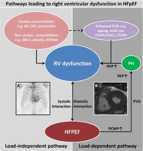 Pathways Leading To Right Ventricular Dysfunction In Heart Failure With