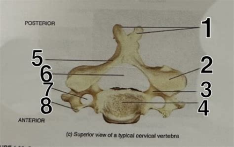 Superior View Of A Typical Cervical Vertebra Flashcards Quizlet