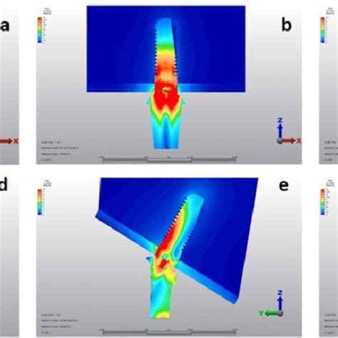 Implant Abutment Connection Designs A Apical View Of Internal Hex