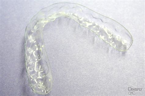 Free Nhs Braces Retainers And Nhs Orthodontic Treatments Purely