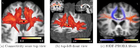 Mapping Neuronal Fiber Crossings In The Human Brain