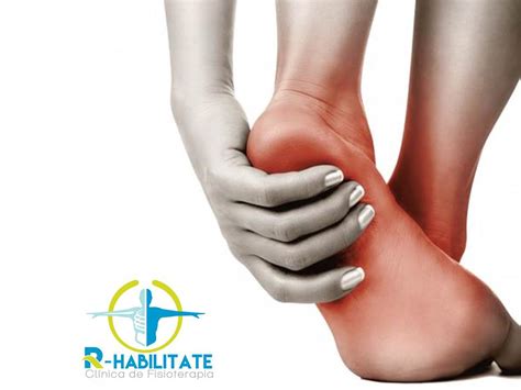 Fascitis Plantar Como Prevenir Y Tratar R Habilitate