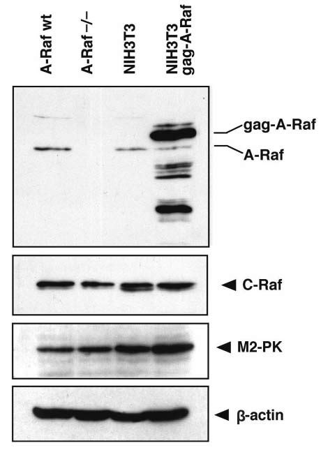 Western Blot Analysis Of The Different Fibroblast Cell Lines Primary