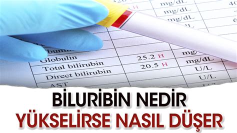 Bilirubin Nedir