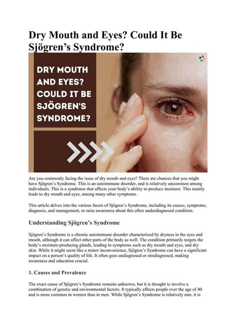 Dry Mouth And Eyes Could It Be Sjögrens Syndrome The Lifesciences