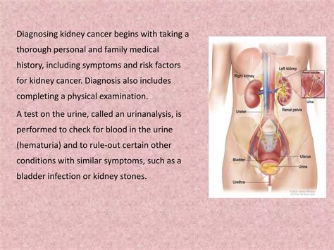 Kidney Cancer Renal Cancer Ppt