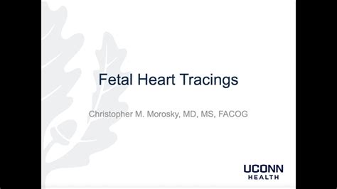 Fetal Heart Tracings Youtube