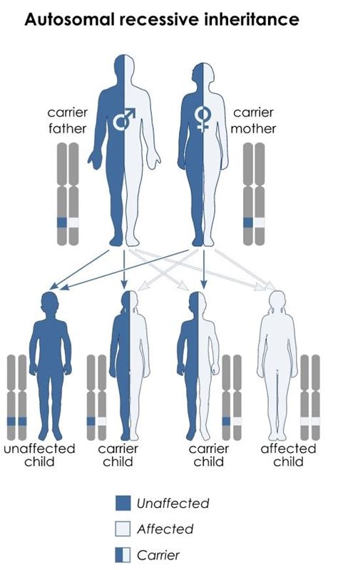 Aagenaes Syndrome Symptoms