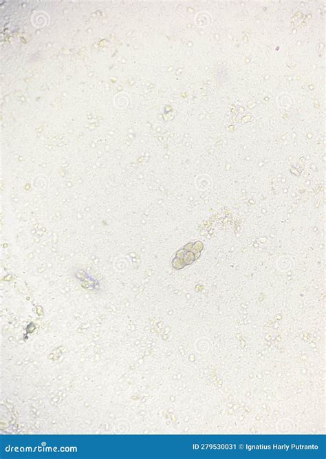 Hook Worm Eggs of Parasite in Stool Examination Stock Image - Image of