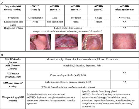 Frontiers Perspectives On Oral Chronic Graft Versus Host Disease From