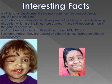 PPT - Neurofibromatosis 1 PowerPoint Presentation, free download - ID ...