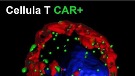 Approvata In Italia La Terapia Genica Car T Innovativa Per Alcuni Tipi