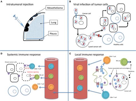 The Basic Principles Of Oncolytic Virotherapy A Administration Is