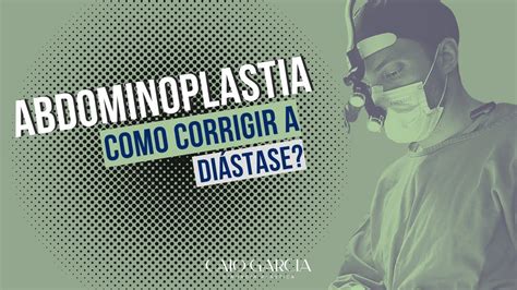 Cirurgia Pl Stica Abdominoplastia Como Corrigir A Di Stase Youtube