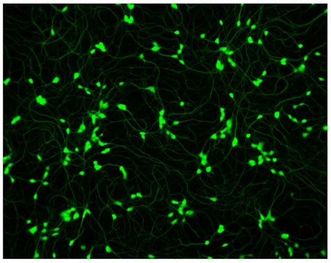 Human Spinal Motor Neurons GFP Expressing Male WC 30 Ab315365