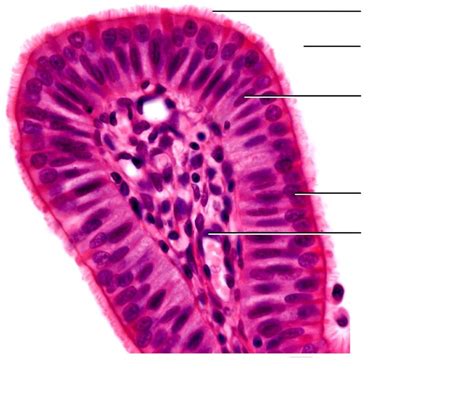 Fallopian Tube Histology Diagram | Quizlet