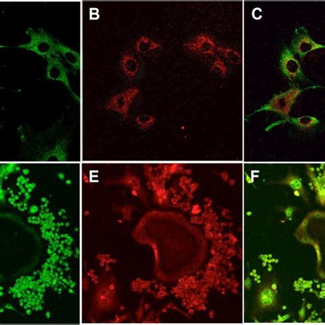 Immunostaining Confirms The Presence Of The SP Neurokinin 1 Receptor