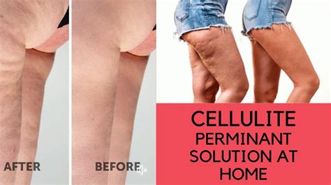 How I Got Rid Of My Cellulite Home Workout For Thigh Fat At Home