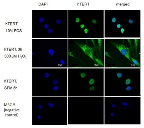 Ijms Free Full Text Telomerase Does Not Improve Dna Repair In