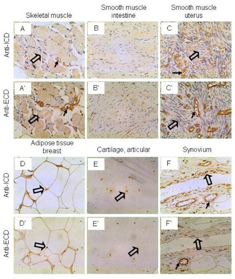 Il 17rc Expression In Miscellaneous Tissues Arrows Endothelium And