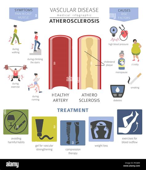 Infografia De Prevencion De Enfermedades Cardiacas Y Aterosclerosis