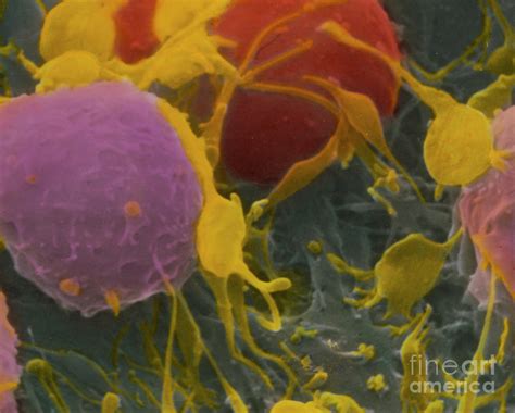 Sem Of Activated Platelets In Human Blood Photograph By Professor Pm