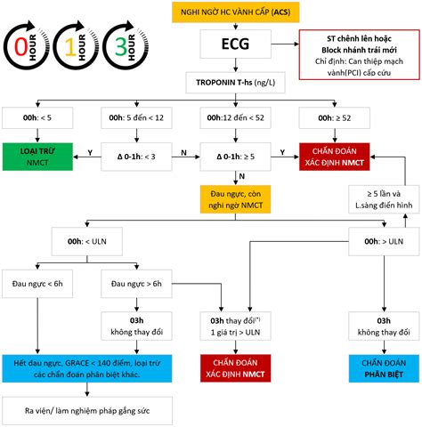 Chẩn đoán nhồi máu cơ tim Những phương pháp chính xác và hiệu quả