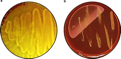 Hemolysis Activity Of L Ivanovii Subsp Ivanovii Atcc A