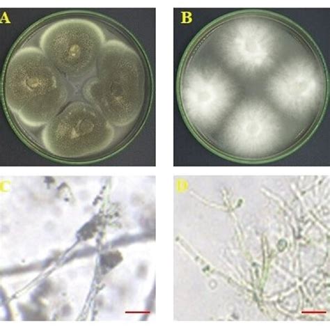 Macroscopic And Microscopic Of Endophytic Fungi Afl And Afl On The