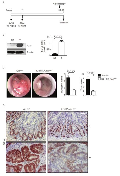 IL 21 Deficiency Significantly Reduces Colon Tumorigenesis In Apc Min