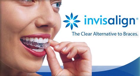 Invisalign Monmouth County NJ Holmdel Dentist Orthodontics Braces