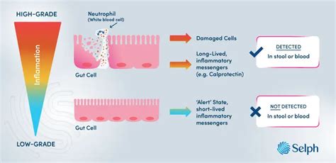 What Is Gut Inflammation And How Do I Test For It