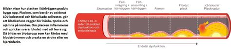 Hj Rt K Rlsjukdomar Typer Symtom Prevention Och Behandling Amgen