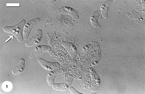 Fresh Spores Of C Bassoni Sp N Note Abnormal Spore With Three Polar