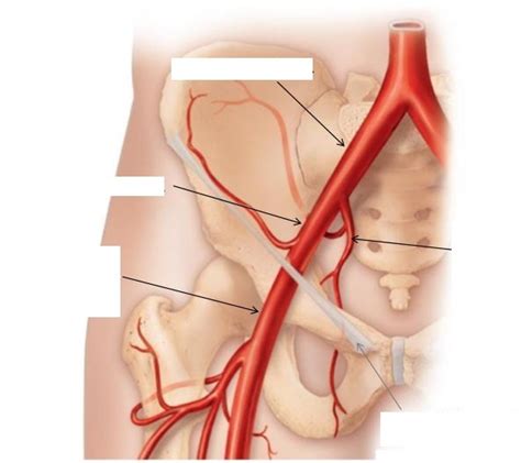 Iliac Arteries Diagram Quizlet