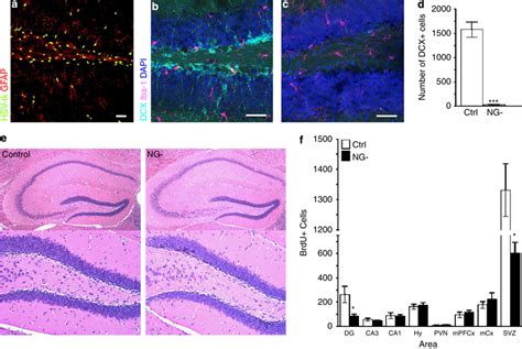 Immunohistochemistry Against Hsv Tk And Gfap In The Hippocampal Dentate