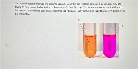 Solved Some Bacteria Produce The Enzyme Urease Describe Chegg