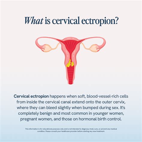 Bleeding After Sex No Pain: All Causes Explained | Happy V
