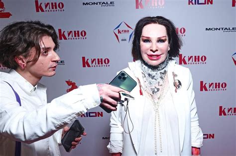 Агузарова после пластики