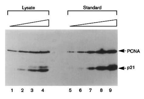 Subcellular Distribution Of P21 And Pcna In Normal And Repair Deficient