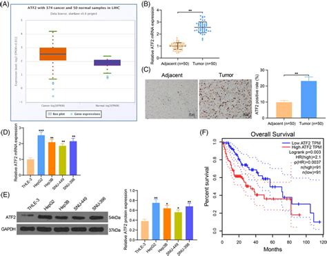 Atf Is Highly Expressed In Hcc Tissues And Cells And Indicates